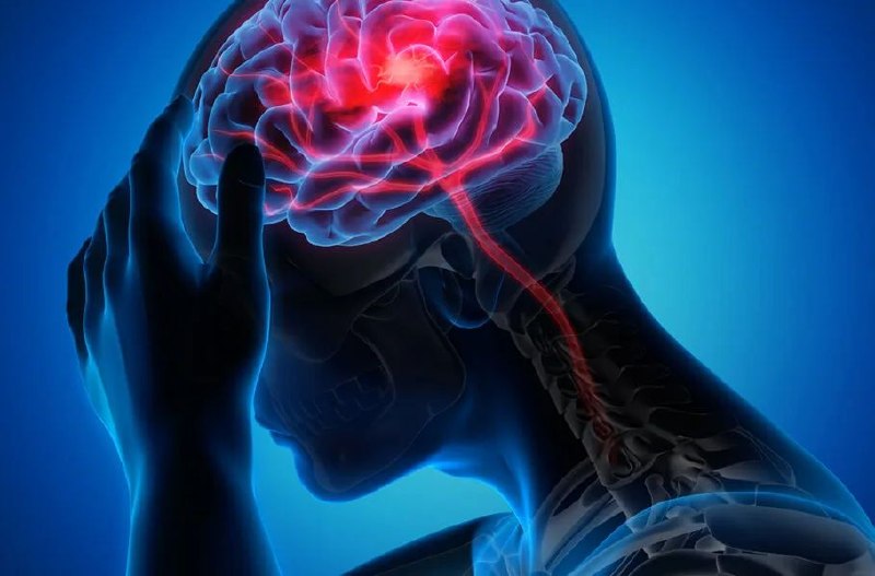 هوش مصنوعی با تحلیل DNA ریسک سکته مغزی ایسکمیک را پیش‌بینی می‌کند