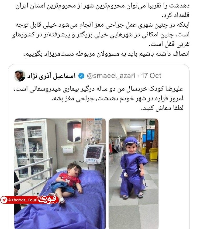انجام جراحی مغز کودک دو ساله در دهدشت