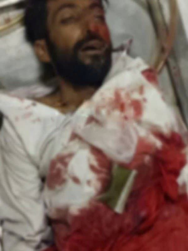 حذف تروریستی که در جاده چشم‌زیارت زاهدان بمب‌گذاری کرده بود